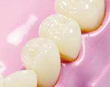 Product 1535 Image